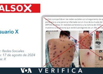 La persona de esta imagen no tiene lesiones por rifle como se dice en X, es un caso de viruela símica