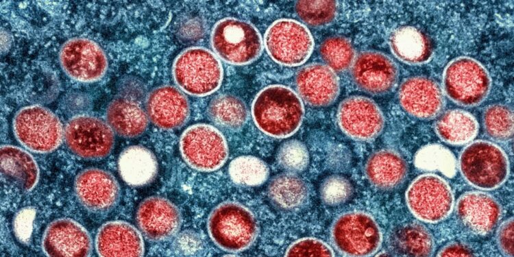 descartan que uno de los tripulantes de buque en el río Paraná tenga mpox