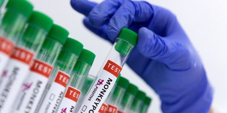 Venezuela activa vigilancia epidemiológica por Mpox o viruela del mono