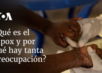 ¿Qué es el mpox y por qué hay tanta preocupación?
