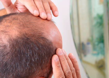 Científicos descubren tratamiento con células T que podría hacer crecer de nuevo el cabello perdido