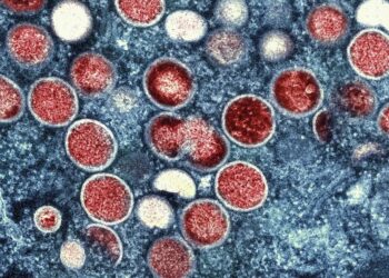 Argentina aisla barco carguero por caso sospechoso de viruela del mono