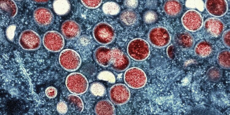 Argentina aisla barco carguero por caso sospechoso de viruela del mono