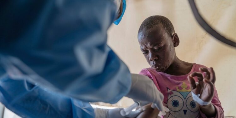El Congo recibirá su primer lote de vacunas contra la viruela símica