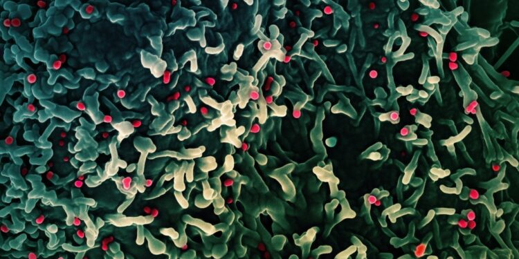 Barco en la región Argentina de Rosario en cuarentena por posible caso de mpox