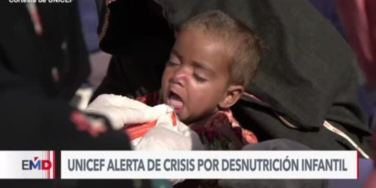 Casi dos millones de niños en riesgo de muerte por desnutrición severa