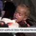 Casi dos millones de niños en riesgo de muerte por desnutrición severa