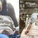 INSÓLITO:Un paciente con muerte cerebral recuperó la conciencia cuando le iban a extraer sus órganos