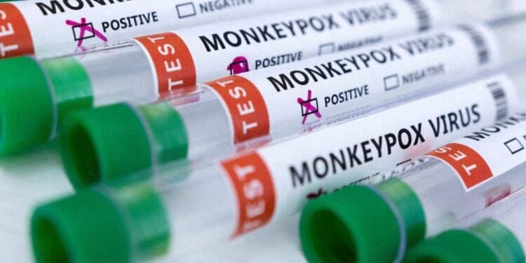 La viruela símica sigue siendo una emergencia de salud pública, según la OMS