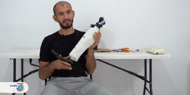 Artista nicaragüense diseña prótesis para personas mutiladas