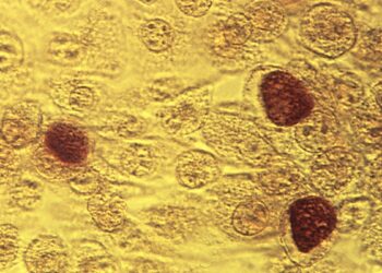 Enfermedades de transmisión sexual en EEUU empiezan a disminuir tras fuerte repunte de años pasados