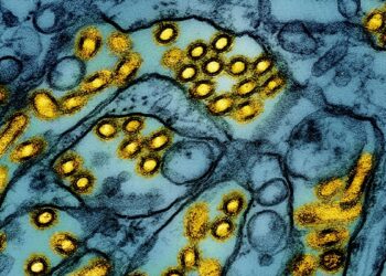 California reporta primer caso confirmado de gripe aviar en un niño en EEUU