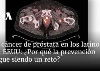¿por qué la prevención sigue siendo un reto?