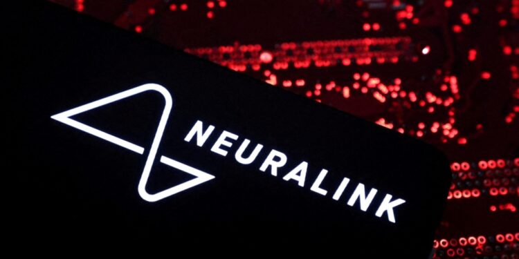 Neuralink, de Musk, iniciará un ensayo de viabilidad con implante cerebral y un brazo robótico