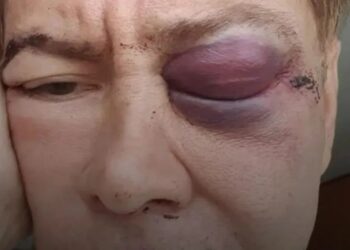 Diseñador de modas murió en Caracas: Días después de recibir una golpiza en un centro comercial