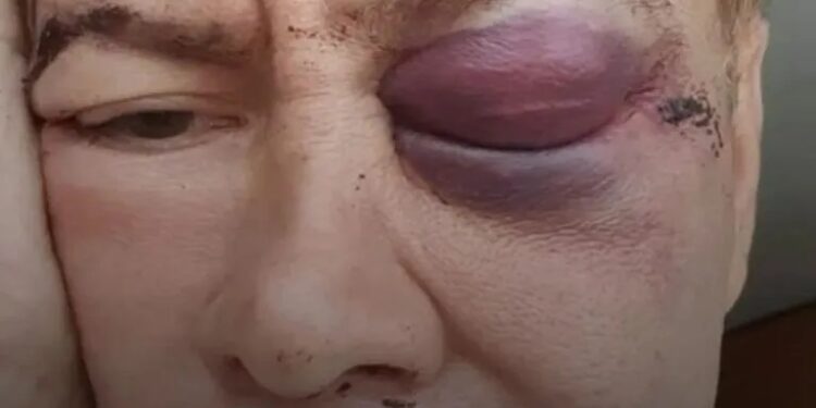 Diseñador de modas murió en Caracas: Días después de recibir una golpiza en un centro comercial