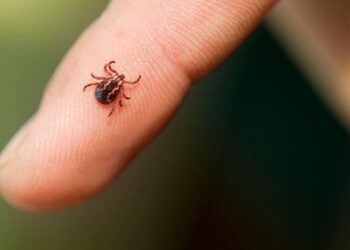 ¡Invasión en miniatura! Cientos de garrapatas se alojan en el oído de una niña causándole dolor de cabeza y cuello