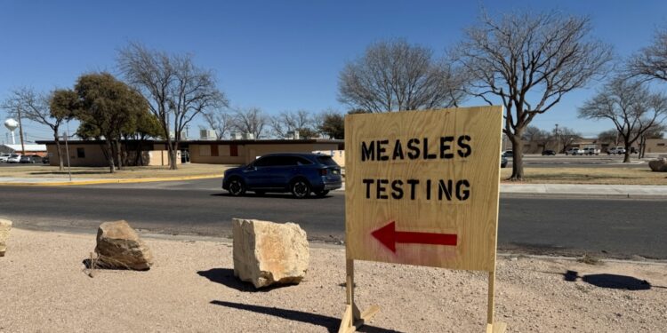 A medida que aumentan los casos de sarampión en EEUU, ¿cuál es la situación a nivel mundial?