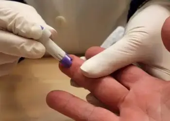 Desmienten 5.000 nuevos casos de VIH en Carabobo: «No son nuevos diagnósticos»