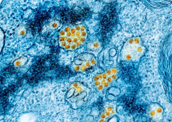 Ascienden a 34 muertos por fiebre amarilla en Colombia