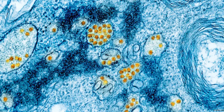 Ascienden a 34 muertos por fiebre amarilla en Colombia