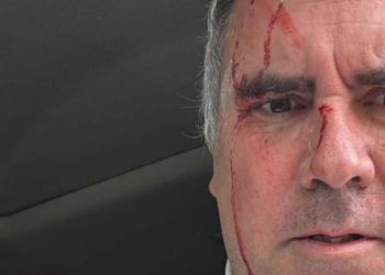 Candidato presidencial de Perú sobrevive a un atentado tras ser tiroteado en su vehículo